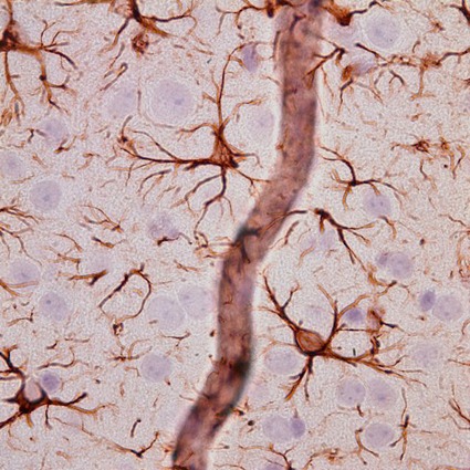 Astrocytes and bb GFAP 72