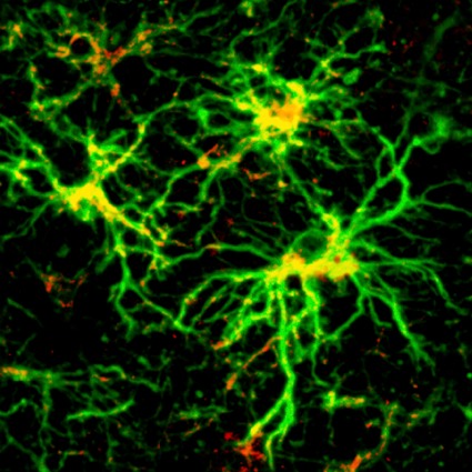 Astrocytes GFAP-HSP27 72