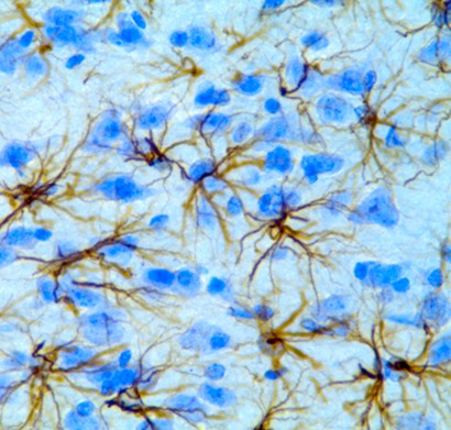 Astrocytes GFAP 72