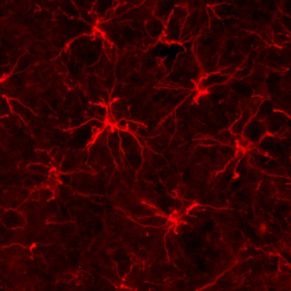 Astrocytes red 72