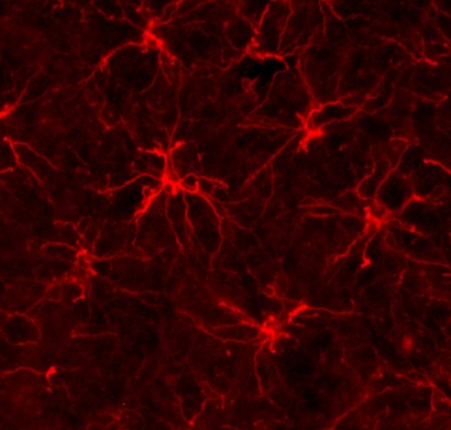 Astrocytes red 72