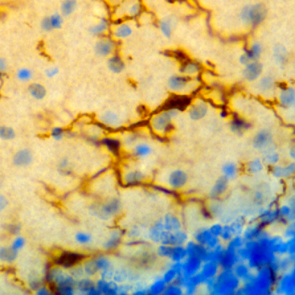 Microglia Iba1 72