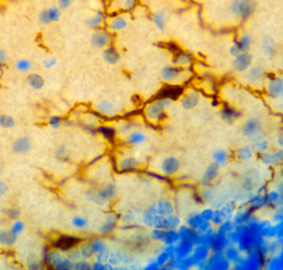 Microglia Iba1 72