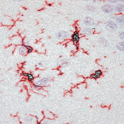 Microglia Iba1 parafin 72