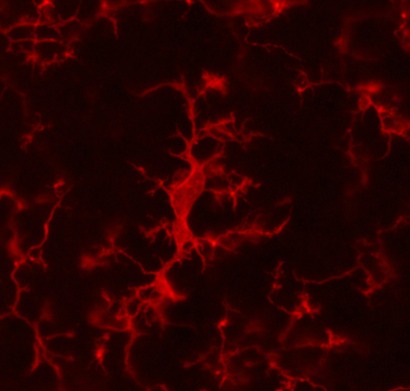 Microglia Iba1 red 72