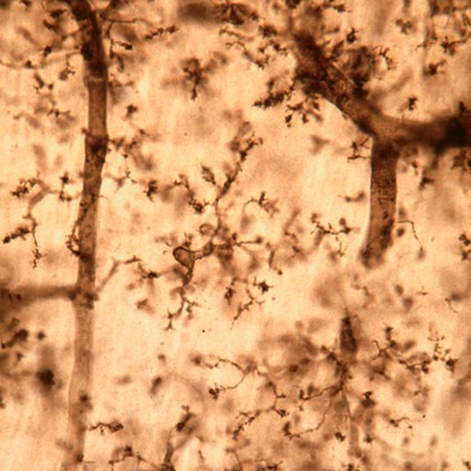 Microglia NDPase hippocampus 72