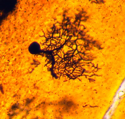 Purkinje neuron