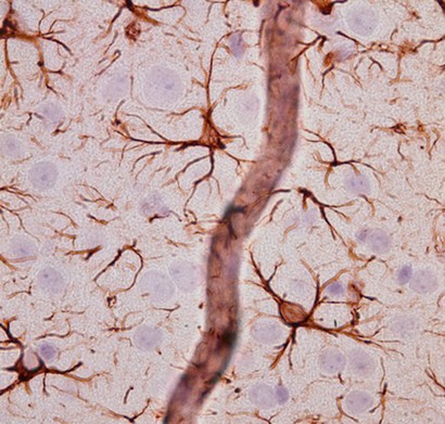 Astrocytes and bb GFAP 72