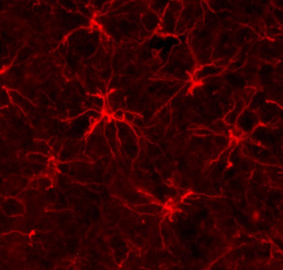 Astrocytes red 72